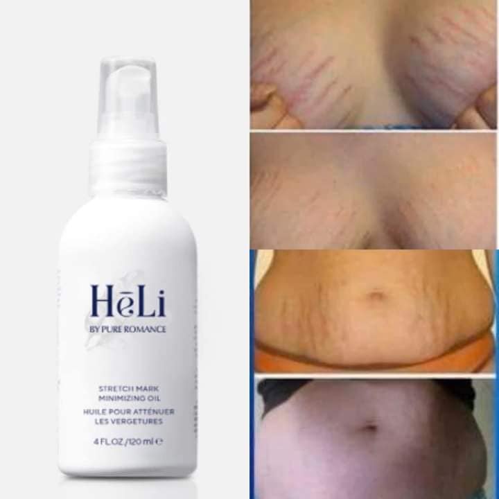 Hēli - Stretch Mark Minimizing Oil - 23 LEFT!